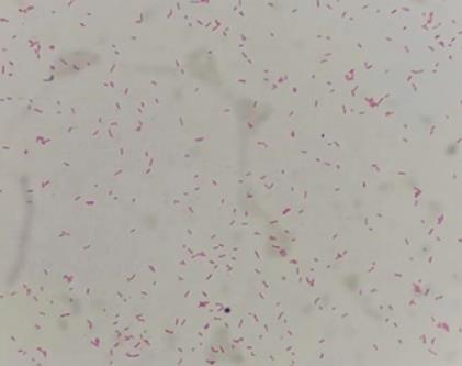 細(xì)菌血培養(yǎng)陽(yáng)性、陰性結(jié)果報(bào)告解讀