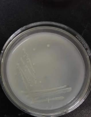 解磷菌是什么菌？解磷微生物種類及分布