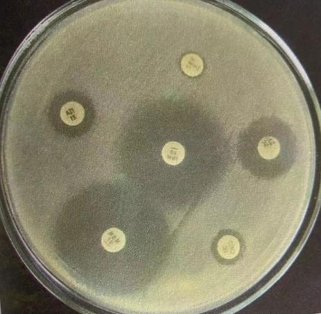 抗生素的作用機(jī)制及藥敏試驗(yàn)方法