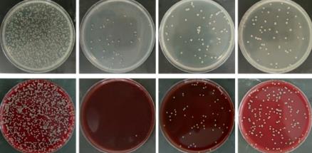 胞內(nèi)菌分類|sRNA對胞內(nèi)菌生長的調(diào)控作用（一）