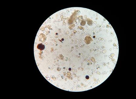 ?土壤中有哪些微生物？土壤微生物在生態(tài)系統(tǒng)中的作用