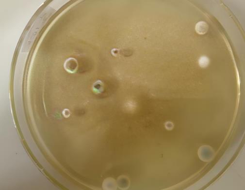 改善不可培養(yǎng)微生物可培養(yǎng)效率的方法有哪幾種