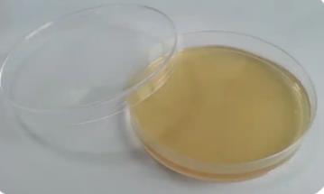 什么是不可培養(yǎng)微生物？原因是什么