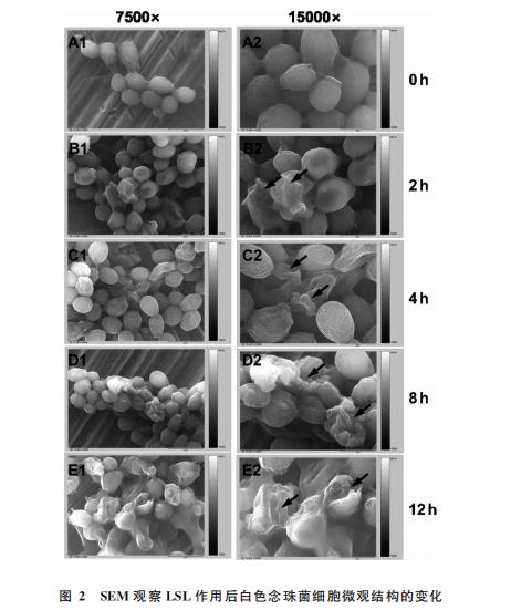 內(nèi)酯型槐糖脂對(duì)白色念珠菌生長(zhǎng)抑制和生物膜形成的影響（二）