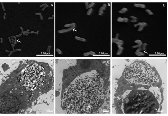 貝氏柯克斯體在高滲脫水環(huán)境中的生物學(xué)特性研究（三）
