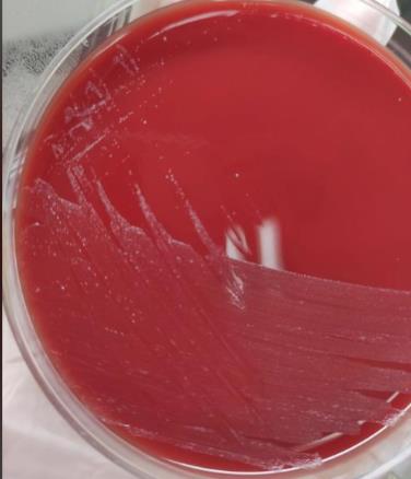 不同保存條件、培養(yǎng)基對淋病奈瑟菌存活率的影響——摘要、材料與方法